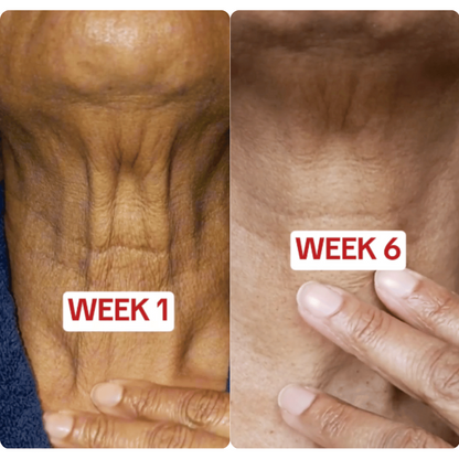 Navaro™ Collagen Lifting Ampoule